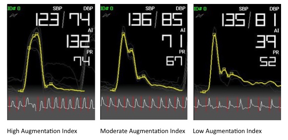 BP+ Augmentation Index Graph