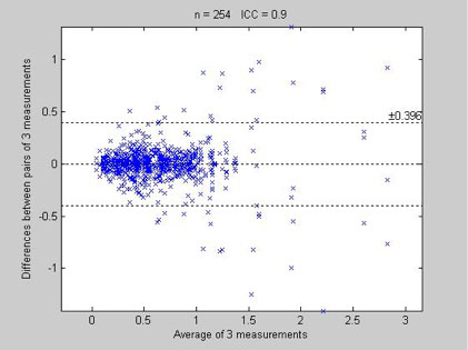 BP+ Intra session Augmentation Index below 300